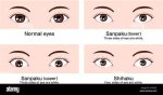 Understanding Sanpaku Eyes: Their Significance and Cultural Impact